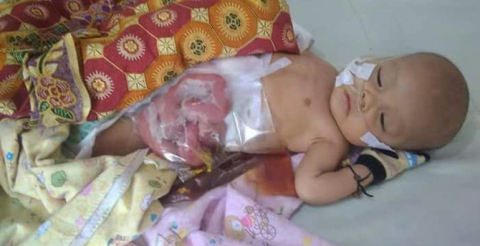 Muhammad Iksan Sayuti Putyra, bayi yang butuh uluran tangan para dermawan (Foto : Istimewa) RELIGI